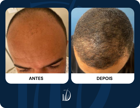 resultados_tc_01 (1)